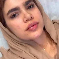 ژل لب بوتاکس فیلر انزیم ساکشن غبغب گونه زاویه سازی|خدمات آرایشگری و زیبایی|مشهد, سجاد شهر|دیوار