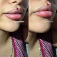 تزریقات ژل شروع قیمت از 750|خدمات آرایشگری و زیبایی|شیراز, شهرک مفتح|دیوار