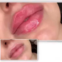 کلینیک زیبایی غزال|خدمات آرایشگری و زیبایی|تهران, خزانه|دیوار
