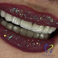 دندانپزشکی کامپوزیت و درمانی|خدمات آرایشگری و زیبایی|تهران, سلسبیل جنوبی|دیوار