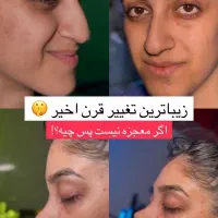 اف زیبایی بینی و لیپو
