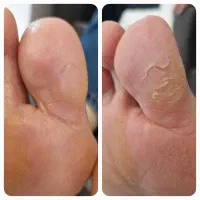 پدیکور پا مخصوص بانوان