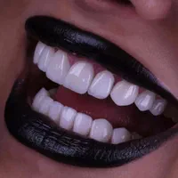 اموزش کامپوزیت ۱۰ میلیون