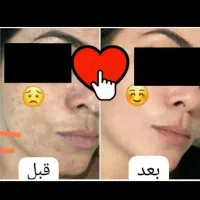 کرم معجزه اصل با گارانتی مرجوعی|آرایشی، بهداشتی، درمانی|سرپل ذهاب, |دیوار