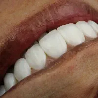 دستیار مطب دندانپزشکی