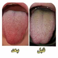 درمان بیمارهای ک بیخبری ازشون و تناسب اندام