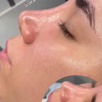 خدمات فیشیال و پاکسازی