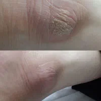 پدیکور درمانی|خدمات آرایشگری و زیبایی|اسدآباد, |دیوار