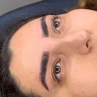 فیبروز ابرو
