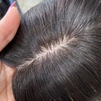 پروتز بالا سر طبیعی|آرایشی، بهداشتی، درمانی|تهران, دریاچه شهدای خلیج فارس|دیوار