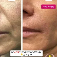 مراقبتی و ارایشی|آرایشی، بهداشتی، درمانی|جوانرود, |دیوار