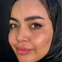 متخصص ژل و بوتاکس و آنزیم و جوانسازها