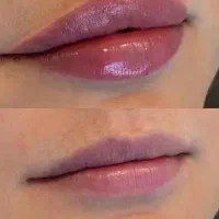 کلینیک زیبایی مجیدیه-لیزر، فیشال، لاغری،بوتاکس