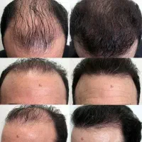 دلت برای موهات تنگ شده راهکارش دسته منه