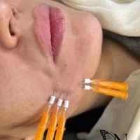 ده سال جوونتر شو (نخ کلاژن)