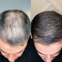 یک شروع تازه برای موهات