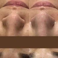 فیشال و مراقبت تخصصی پوست