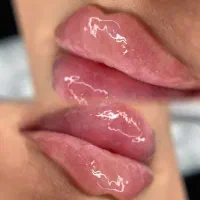 خدمات زیبایی ژل بوتاکس آنزیم مزوتراپی صورت و مو