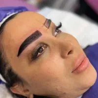 کاشت ابرو/فیشال/تزریق فیلر/لیپوابدو/پی ار پی