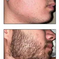 با این رویش ریشات در میاد