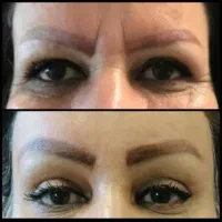 قسطی جراحی بینی و پیکرتراشی و لیفت صورت و ژل|خدمات آرایشگری و زیبایی|تبریز, |دیوار