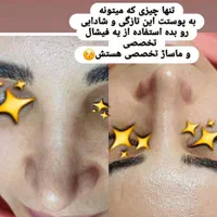 پاکسازی و فیشال تخصصی و درمانی با بهترین برندها|خدمات آرایشگری و زیبایی|پرند, فاز ۲|دیوار