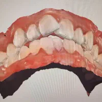 ارتودنسی شفاف دیجیتال