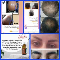 رشد ابرو و مژه 100 درصد|آرایشی، بهداشتی، درمانی|نجفآباد, شهدای غربی|دیوار