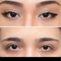 تزریق ژل لب .زاویه فک . بوتاکس. فیلر چانه.|خدمات آرایشگری و زیبایی|تهران, تهرانپارس غربی|دیوار