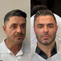 تزریق ژل و بوتاکس طراحی چهره برای زیبایی‌خاص|خدمات آرایشگری و زیبایی|تهران, شادمان|دیوار