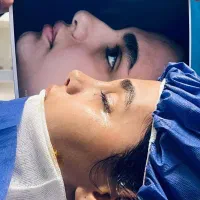 عمل جراحی بینی نئو نوز|خدمات زیبایی و سلامت|تهران, پاسداران|دیوار