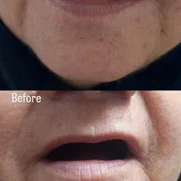 دندانسازی خیریه طرح لمینت|خدمات آرایشگری و زیبایی|مشهد, عامل|دیوار