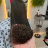 پکیج VIP موخوره گیری تخصصی+کات لیزری+روغن تراپی۳۸۰