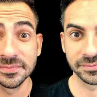 تزریق ژل وبوتاکس،پریسنگ،ارایش دائمصورت تاتوکل صورت