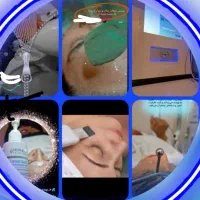 فیشال و پاکسازی جوانسازی پوست کلینیکی فقط ۶۰۰