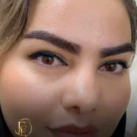 جشنواره کاشت ابروبا شرایط اقساط ویژه به مدت محدود