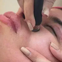 فیشال و جوانسازی و آبرسانی لیفت پوست