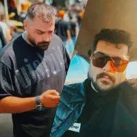 کاشت مو فول تراکم در بوشهر