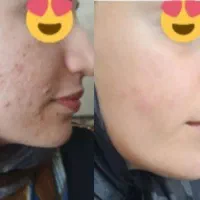 محصولات آرایشی و بهداشتی|آرایشی، بهداشتی، درمانی|تهران, بهار|دیوار