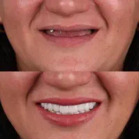 دندانپزشکی تخصصی،ایمپلنت،اوردنچر،ارتودنسی|خدمات آرایشگری و زیبایی|تبریز, |دیوار