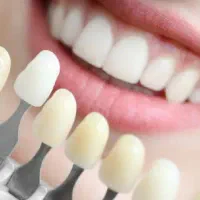 فروش مواد دندانسازی، بلنک زیرکونیا، گلس سرامیک