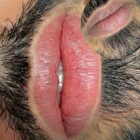 رفع تیرگی لب آقایان