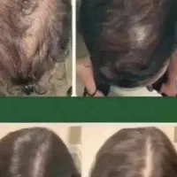 شامپوکافئین جینسینگ مناسب همه نوع  مو