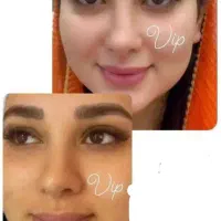 کرم تضمینی صورت معجزه