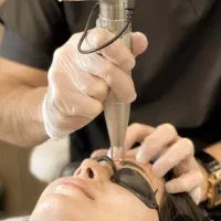 رفع تتو کک ومک وایتنینگ در پردیس