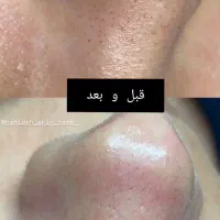 فیشیال|خدمات آرایشگری و زیبایی|رفسنجان, |دیوار