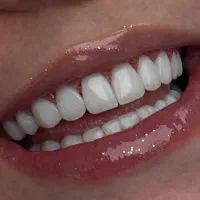 کامپوزیت اقساطی به قیمت ۱۴۰۴|خدمات زیبایی و سلامت|اصفهان, سعادتآباد|دیوار