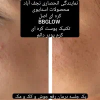 فیشیال مزوتراپی(کرم پودردائم)مرکززیبای تعرفه دولتی|آرایشی، بهداشتی، درمانی|نجفآباد, بازار|دیوار