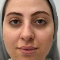 کاشت پدیکور میکاپ|خدمات آرایشگری و زیبایی|کرمانشاه, |دیوار