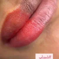 شیدینگ ودکاپاژ لب